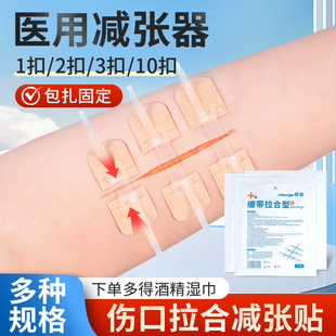 晨业医用减张贴伤口贴儿童拉链式 手术后皮肤创可减张器绷带