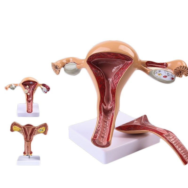 女性生殖系统矢状解剖 女泌尿子宫模型女性盆腔矢状切面模型包邮在类目 玩具/童车/益智/积木/模型, 静态模型, 其他模型玩具中 - 来自Buy2taobao.com提供专业的淘宝代购服务