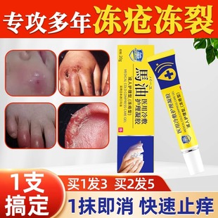 医用冻手冻疮膏防冻防裂冻伤护手霜防冻疮防裂马油蛇油药膏正品