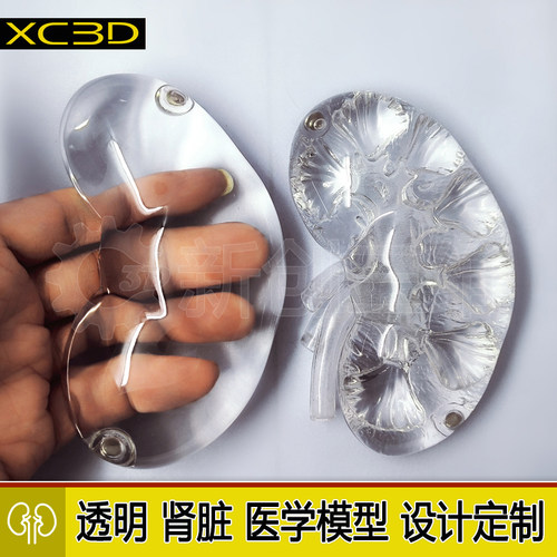 3D打印透明医学医疗肾脏模型定制