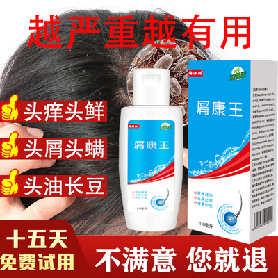 去头皮屑止痒毛囊炎抗真菌洗发水