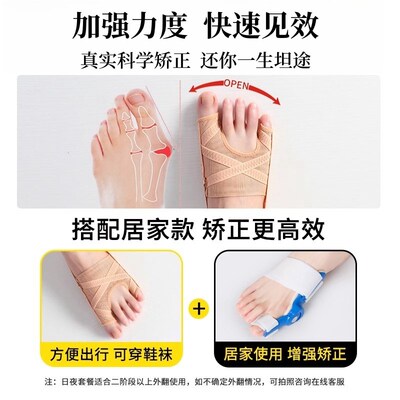 拇指外翻小趾内翻脚趾器脚趾头分离纠正分趾器大脚骨分趾器