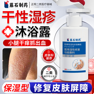 干性湿疹小腿部秋冬天季止皮肤干燥瘙痒儿童宝宝外专用膏沐浴露MY