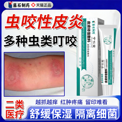 虫咬性皮炎丘疹性荨麻疹专止痒红肿用凝胶植物清凉蚊虫叮舒缓膏YY