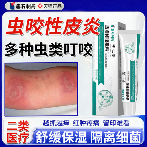 虫咬性皮炎丘疹性荨麻疹专止痒红肿用凝胶植物清凉蚊虫叮舒缓膏YY