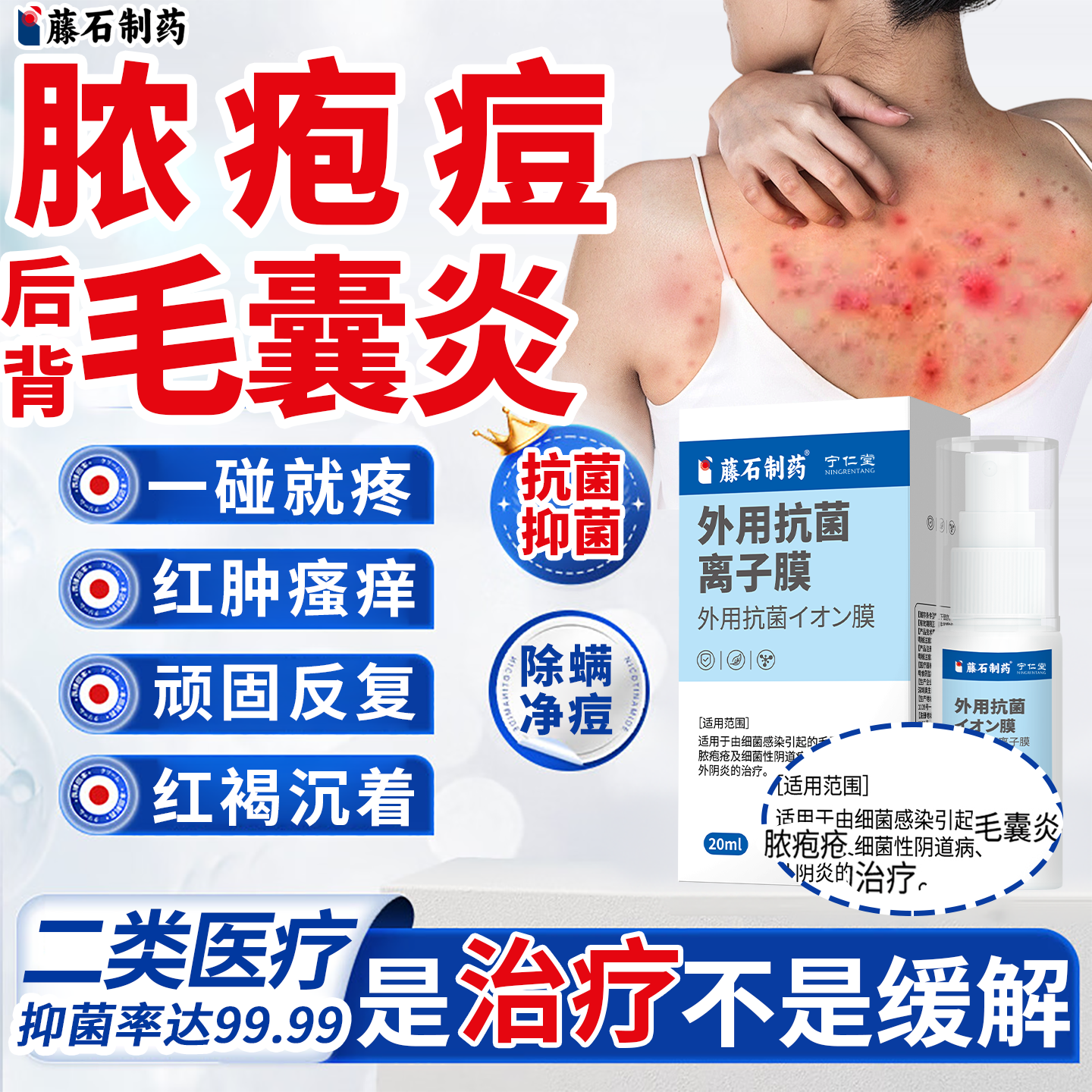 治背后背上长痘痘前胸后背马拉色菌专用膏除螨祛痘痒抗菌喷雾剂YY
