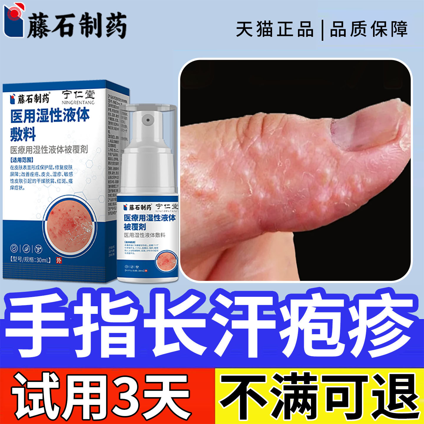 手痒起小水泡手气皮肤瘙痒汗疱疹专去止痒药膏儿童杀脱皮菌用ZY