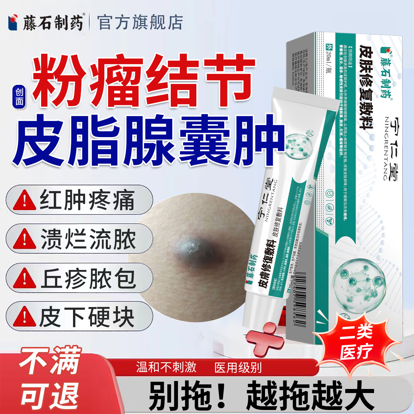 皮脂腺囊肿膏针去火疖子粉瘤硬块拔毒拔脓消瘤特搭专用膏药贴效YU