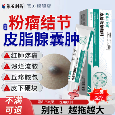 皮脂腺囊肿膏针火疖子粉瘤硬块疙瘩拔毒拔脓特搭去专用膏药贴效YU