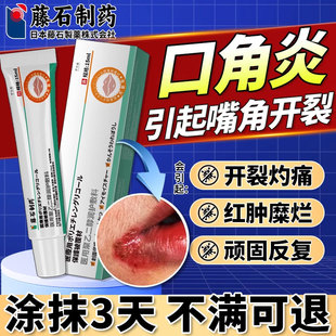 口角炎引起干裂烂嘴角开裂裂口干燥起皮嘴唇脱皮溃疡可搭药膏贴BF
