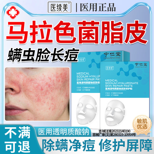 马拉色菌脸部脂溢性皮炎毛囊炎螨虫脸上痘面部非药膏痤疮喷雾YU