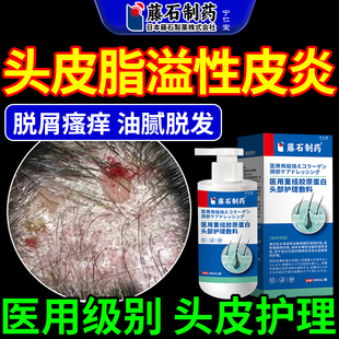 头皮脂溢性皮炎头癣毛囊炎去屑止痒喷雾剂抑真菌感染专用洗发水MY