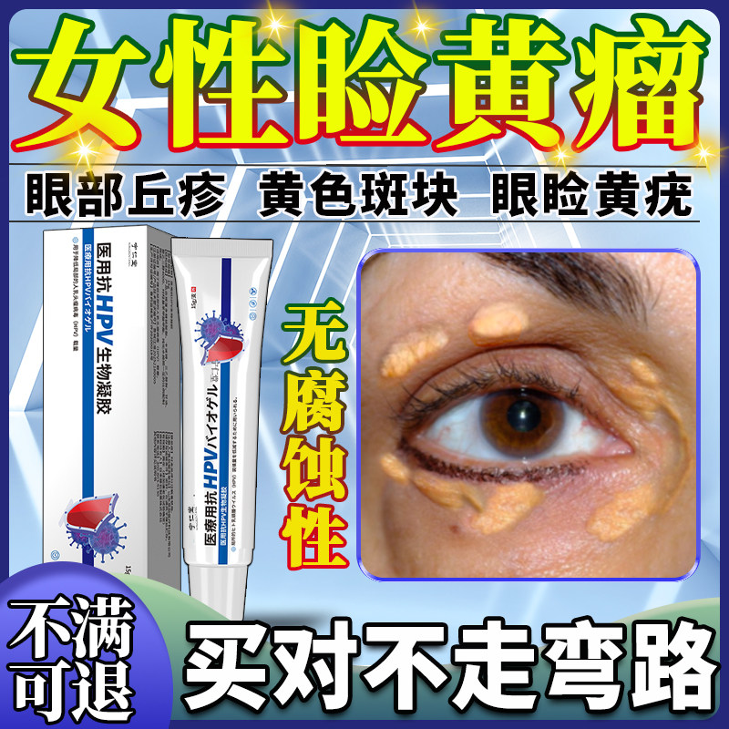 眼睑黄色瘤黄瘤睑黄疣眼角黄斑瘤眼部脂肪粒药监备案膏去除祛BF