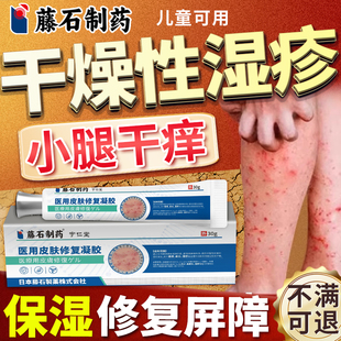 干性湿疹小腿秋冬天季止皮肤干燥瘙痒儿童晚上睡觉身上痒专用膏MY