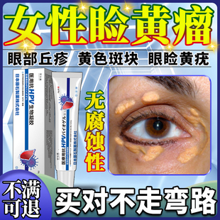 眼睑黄色瘤黄瘤睑黄疣眼角黄斑瘤眼部脂肪粒药监备案膏去除祛BF