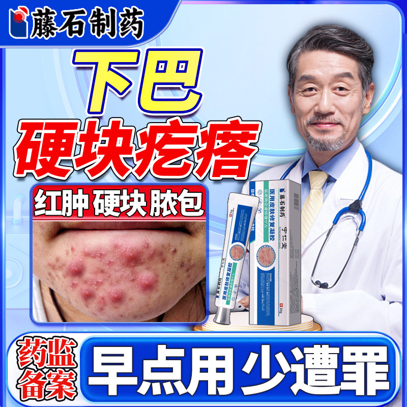 下巴反复长痘硬块痘痘搭膏药贴玫瑰痤疮屏障膏脓包型硬疙瘩BF