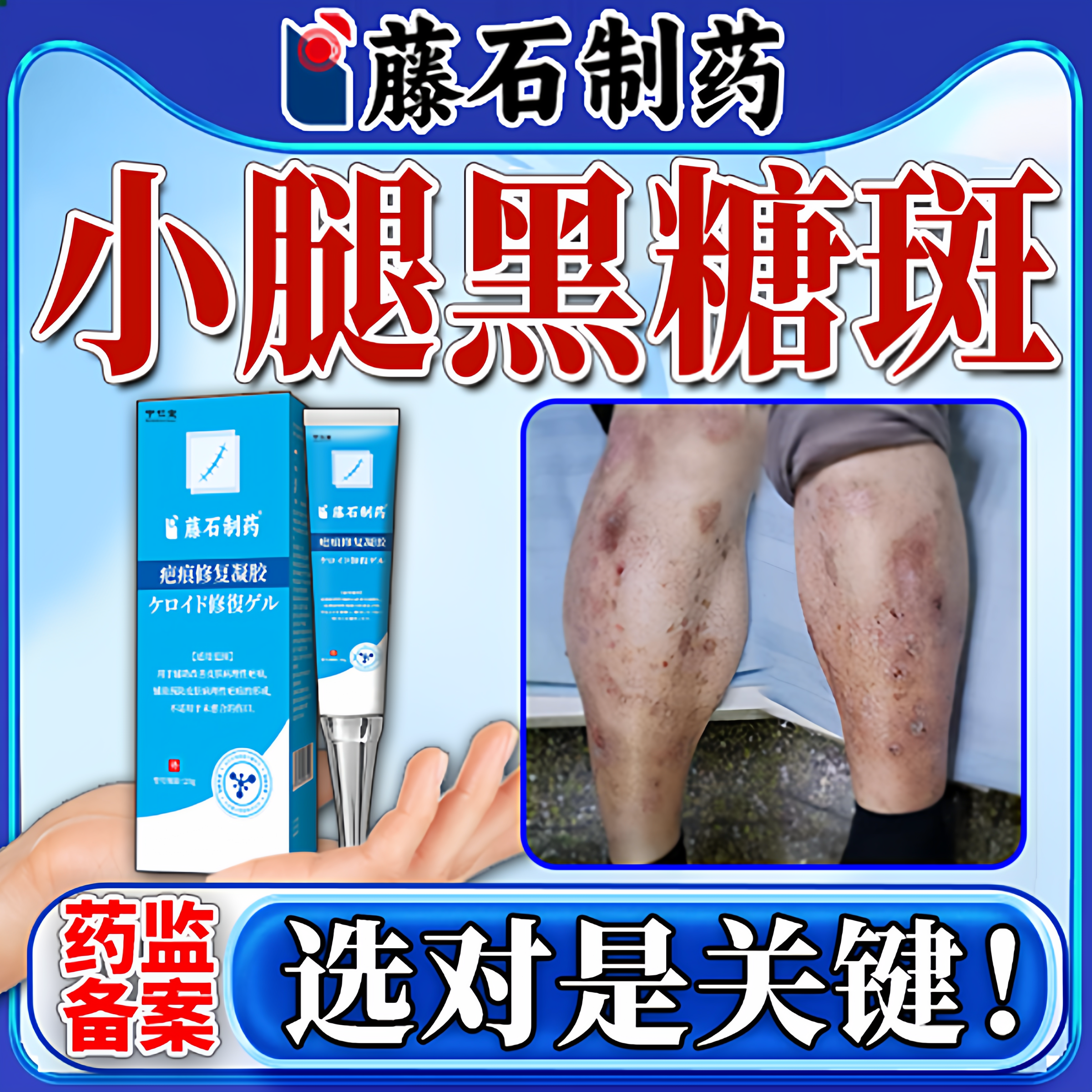 糖尿病足小腿黑斑胫前糖斑腿发黑烂足伤口愈合祛腐搭药膏贴专用BF