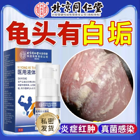 北京同仁堂】龟头包皮炎白垢专用
