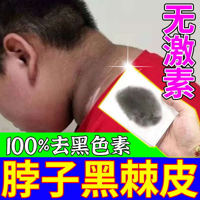 【儿童可用】黑棘皮脖子黑专用