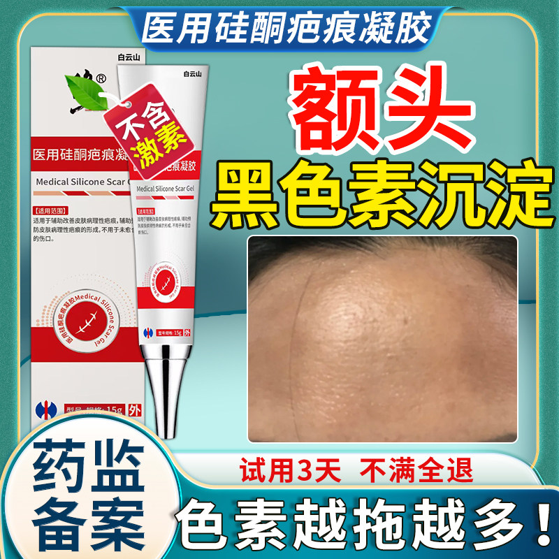 额头黑色素沉淀【去除凝胶】