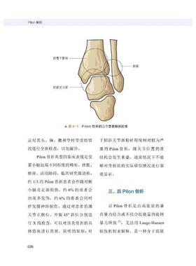 Pilon骨折书李钊伟  医药卫生书籍