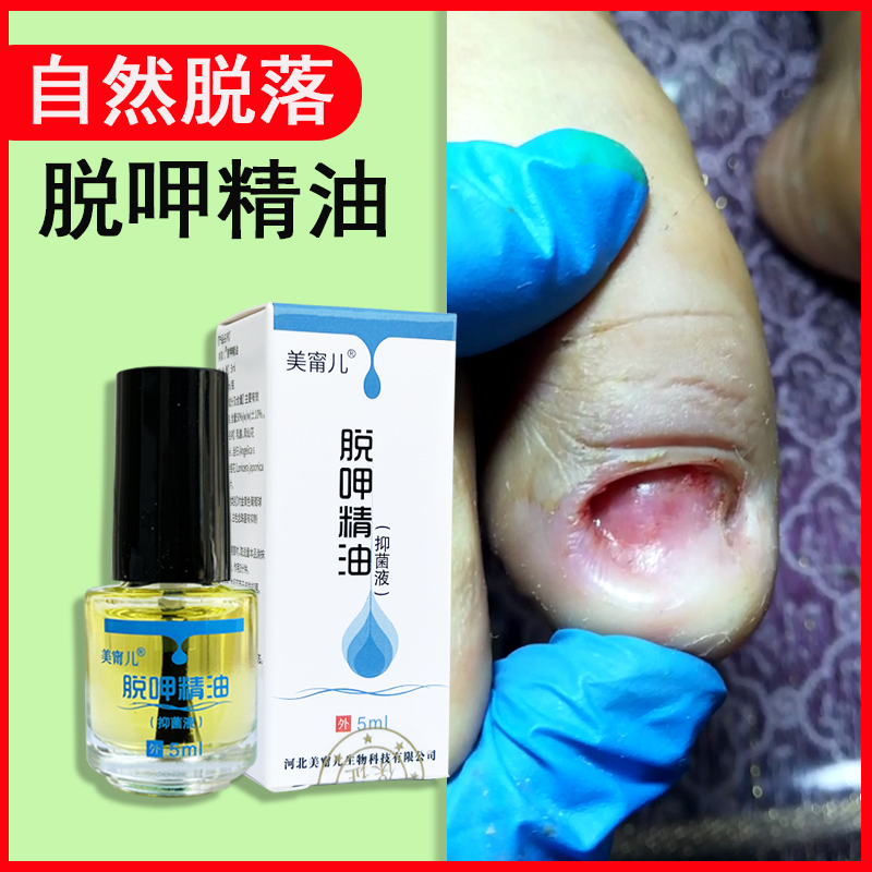 灰甲脱甲精油软甲液快速去灰甲坏甲厚甲无痛卸甲油指甲涂抹软化剂