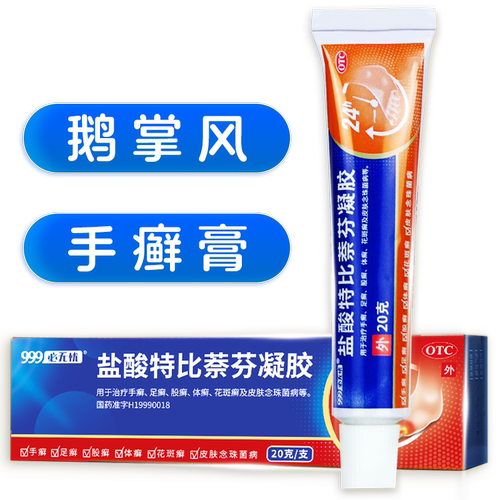 手癣膏脱皮干裂真菌感染鹅掌风专用手癣膏药盐酸特比萘芬正品凝胶