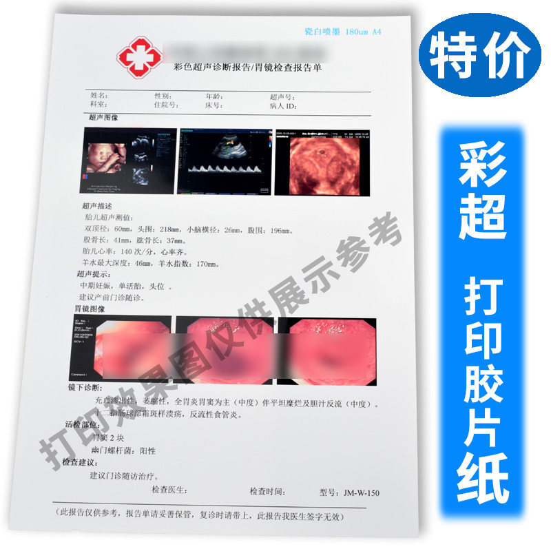 加厚医用胶片瓷白喷墨激光A4胶片打印纸彩超胃肠镜单A3纸13x17