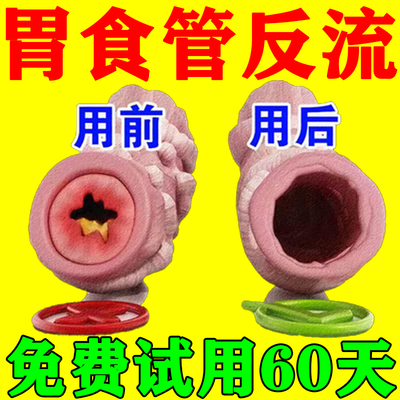 胃食管反流贴治反酸烧心