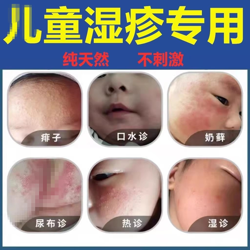 婴儿专用去特应性皮炎奶藓膏