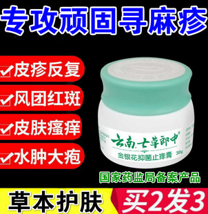 去荨麻疹过敏止痒根风团划痕型成人儿童皮肤瘙痒药玫瑰糠疹专用膏