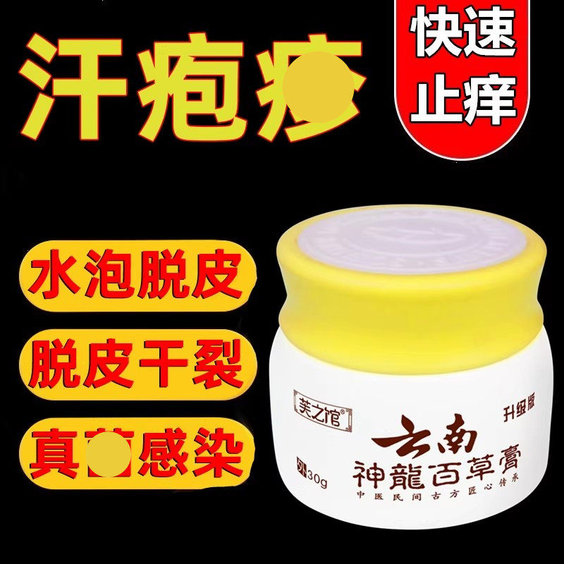 汗疱疹手癣膏季节性脱皮干裂止痒