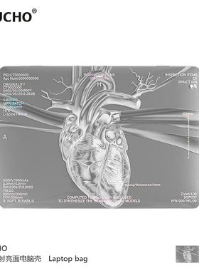 MIUCHO 心脏银色电脑壳适用于苹果24款M2镭射air13透明macbook14磨砂pro原创设计防摔pro16寸防磕碰保护硬壳