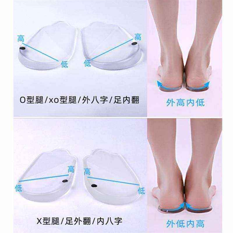脚后跟xo型腿女士舒适脚内翻矫正鞋垫青年八字脚训练器内外八字