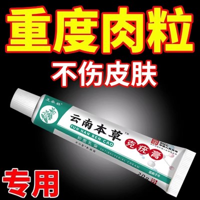 脖子丝状扁平尤克尤克清软膏祛尤灵佳克清软膏尤必净克优膏尤克净