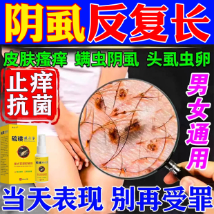 专用喷剂虱子跳蚤药灭虱卵百部酊男女士 硫磺虱立净阴虱一扫光正品