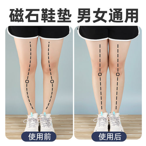 酷姿欣小腿外翻专用神器