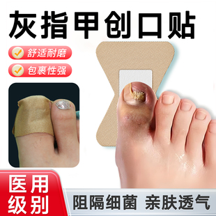 医用灰指甲贴片遮丑贴手指脚趾关节创口贴异形加大高弹防磨脚多片