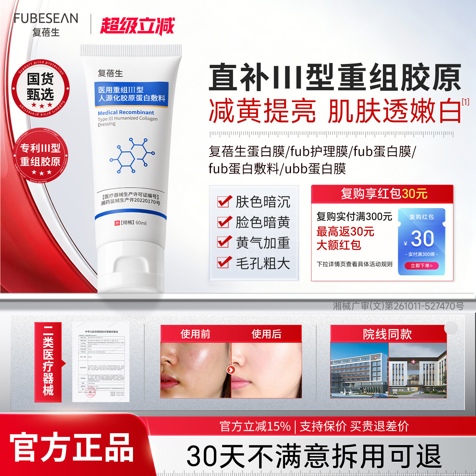 bus蛋白膜fbb蛋白膜ubb蛋白膜fub蛋白膜复蓓生蛋白膜bkk蛋白膜