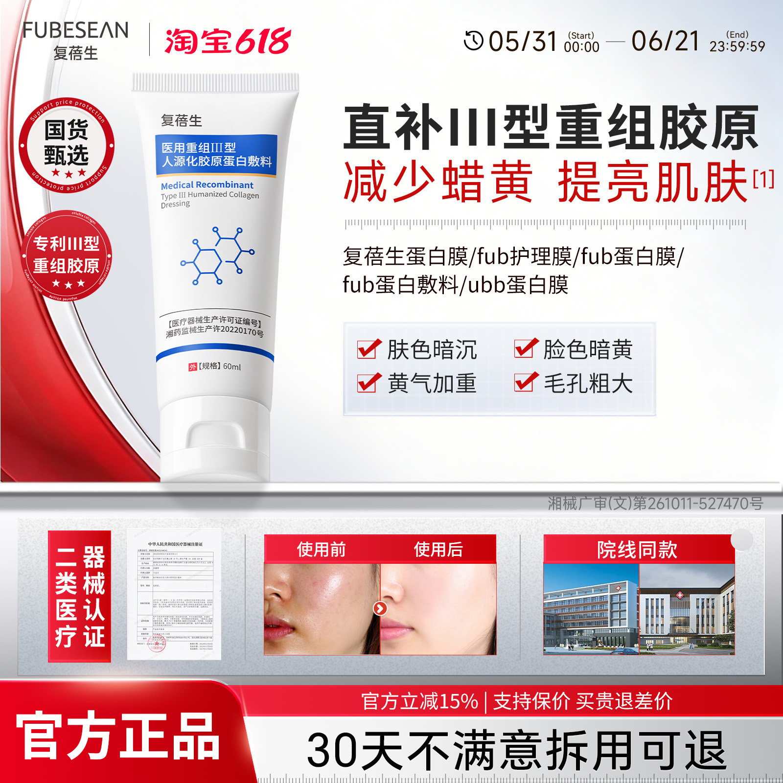 ubb蛋白膜fub蛋白膜复蓓生蛋白膜fbb蛋白膜uss蛋白膜bkk蛋白膜