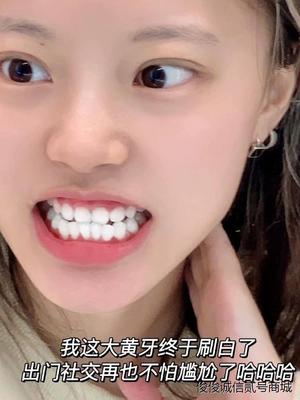 牙粉去黄洗白去口臭美白旗舰店正品清洁污垢结石牙石速效牙齿牙白