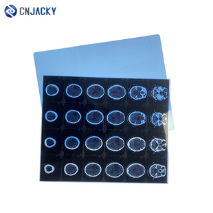 A4高清激光干式蓝色医疗胶片B超CT/CR/DR喷墨打印胶片PVC医用胶片