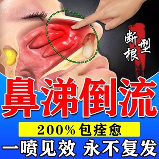 鼻涕倒流专用药鼻后滴漏综合症鼻甲肥大消炎修复鼻腔黏膜特效药剂
