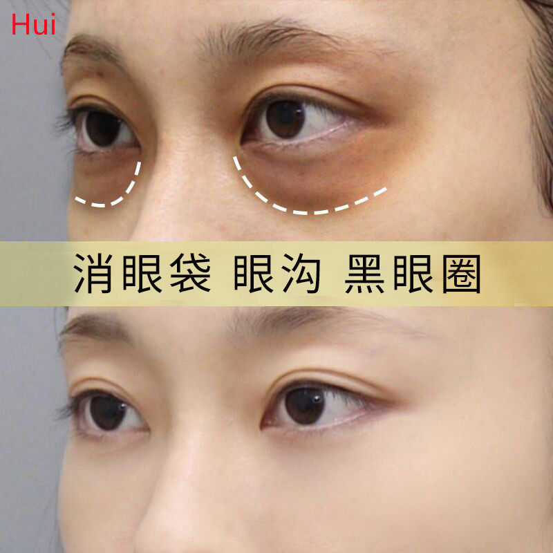 【小红书推荐】跟泪沟说拜拜 眼部丰盈原液 收缩眼袋 去纹精华液