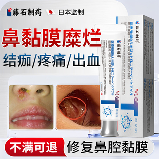 鼻腔黏膜粘膜糜烂修复凝胶喷雾鼻子干燥结痂鼻前庭炎的药房同款YZ