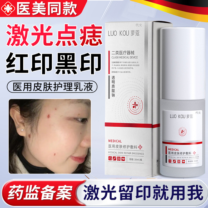 激光点痣斑祛后反黑去疤痕