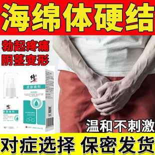 阴茎海绵体龟头硬结节症硬化性男性淋巴管炎弯曲修药房同款复膏BS