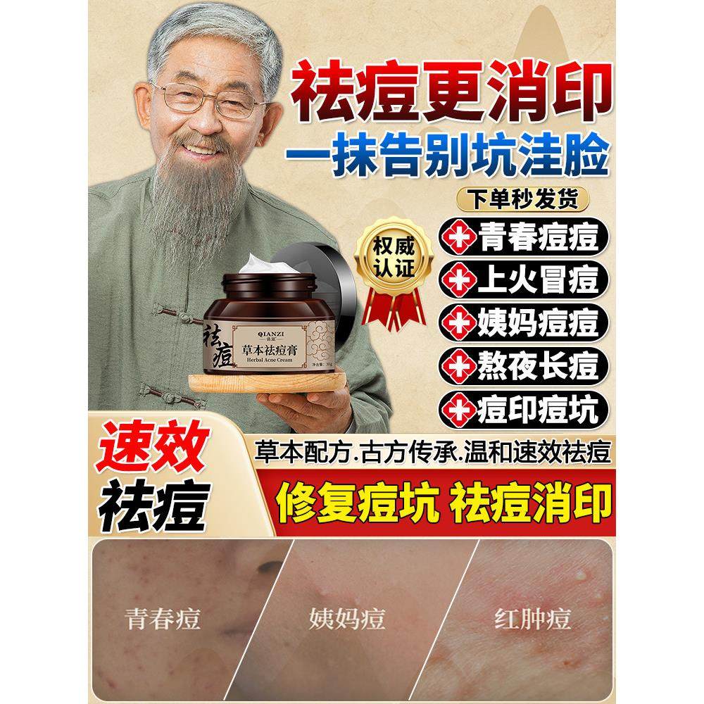 草本祛痘膏祛青春痘淡化痘印温和滋养修护精华面霜官方旗舰店正品,保健用品,皮肤消毒护理（消）,淘宝优惠券,粉丝福利购,淘宝优惠卷