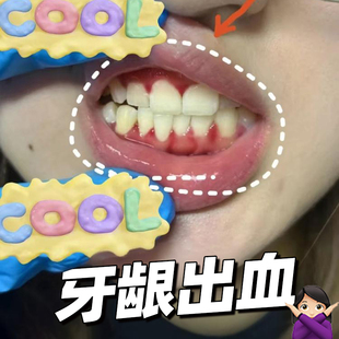 藤石制药牙龈出血凝胶牙周炎牙龈炎敏感牙菌斑可搭牙刷膏漱口水E8