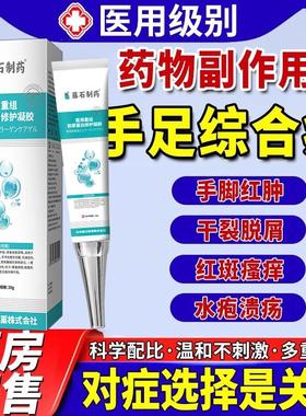 手足综合症征副作用皮肤痒手脚掌干裂脱皮红斑发麻水泡痒愈合膏VQ